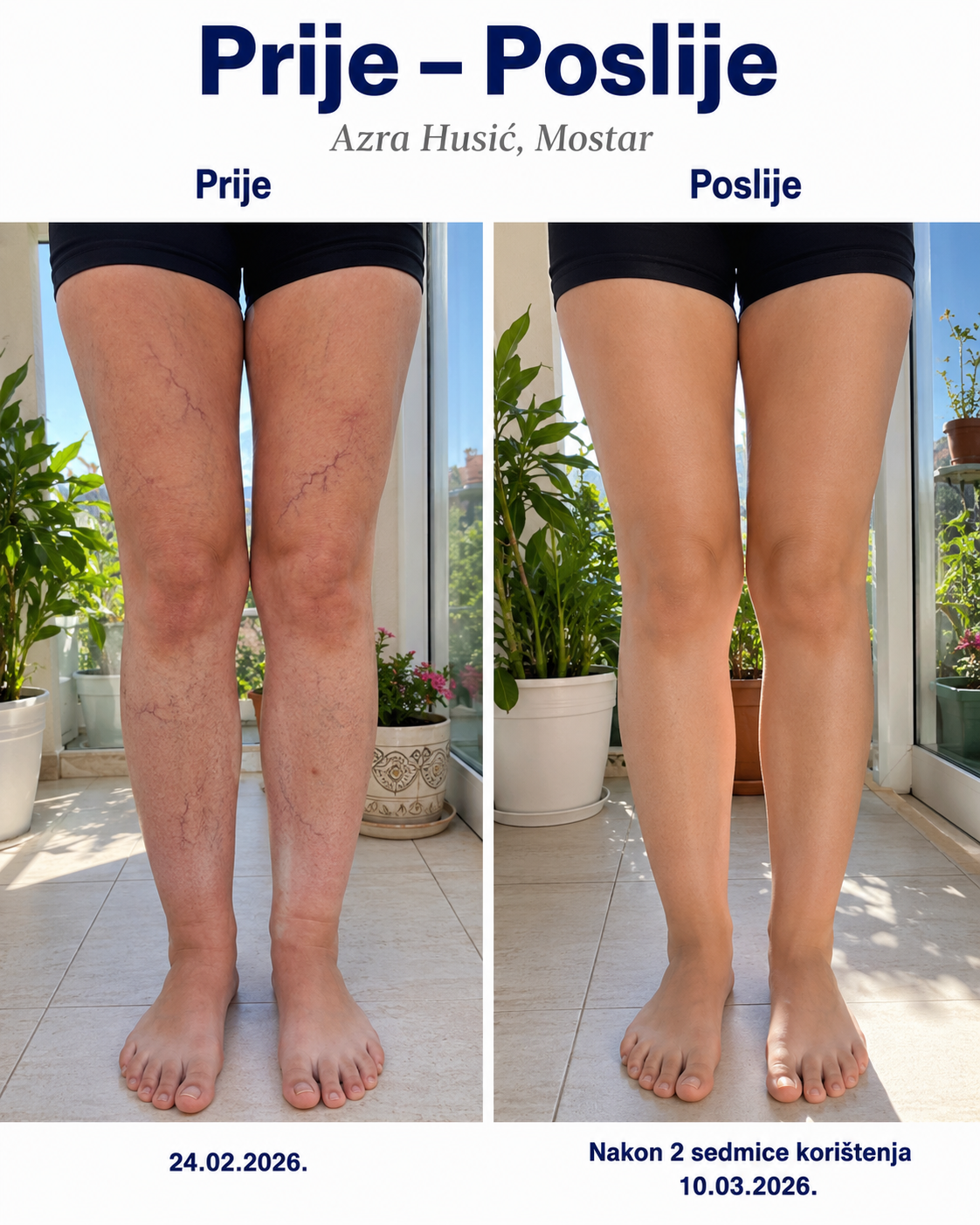Sophia — prije i poslije, kupac 1