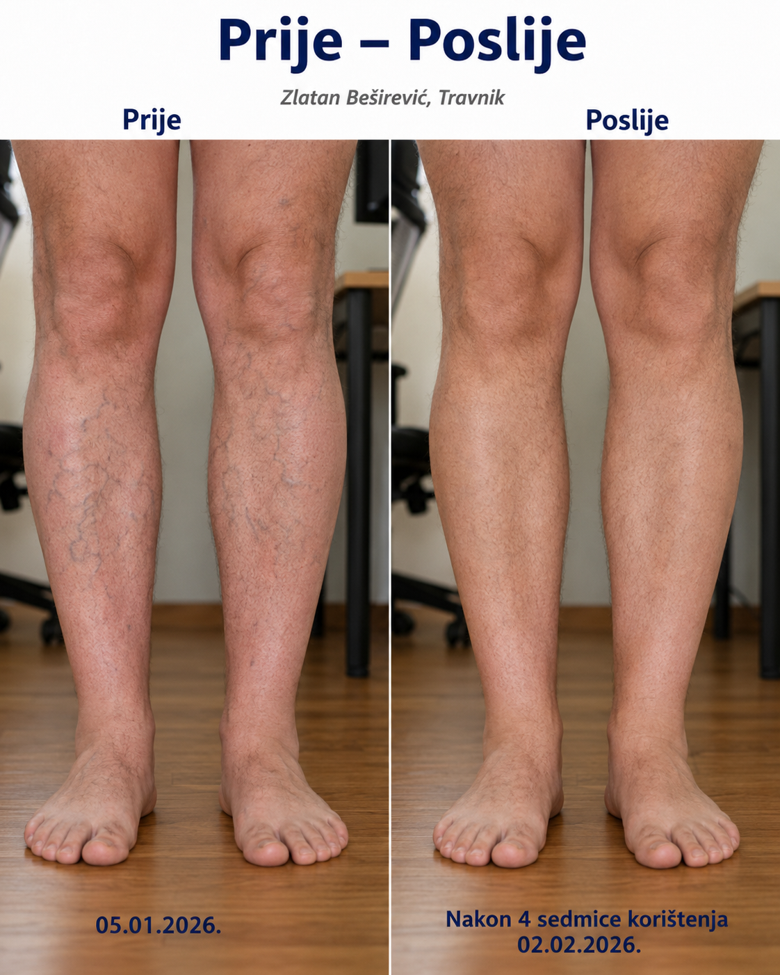 Sophia — prije i poslije, kupac 4